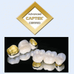 Two 3 unit captek crowns with captek logo